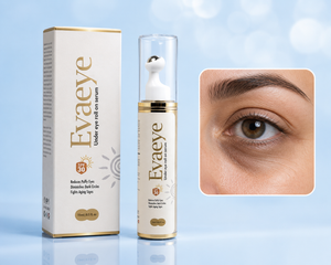 How to Get Rid of Dark Circles and Puffy Eyes Fast