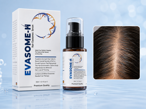 Excessive Hair Shedding? Here's What Actually Helps