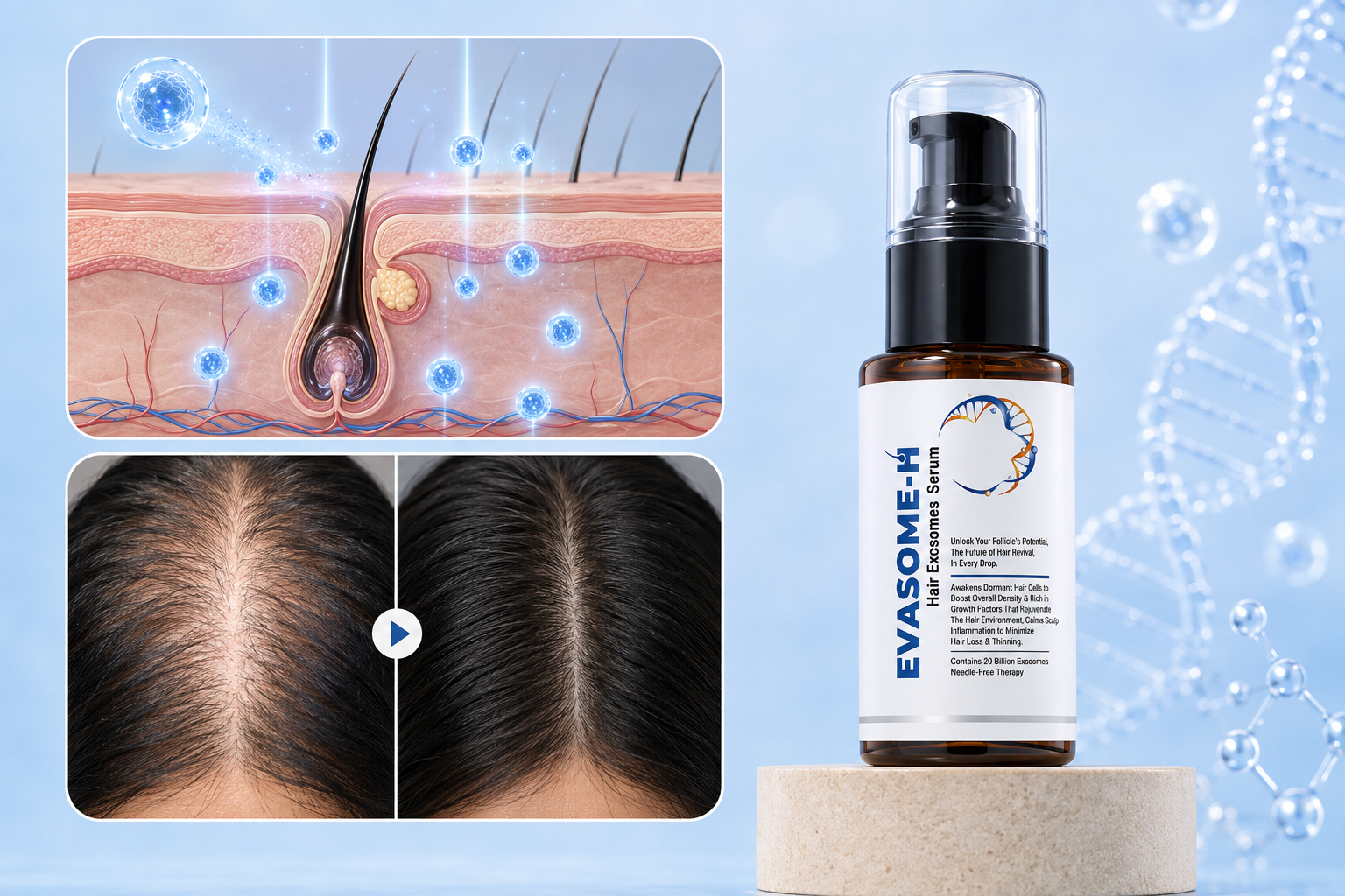 How Exosomes Are Reactivating Dormant Hair Follicles