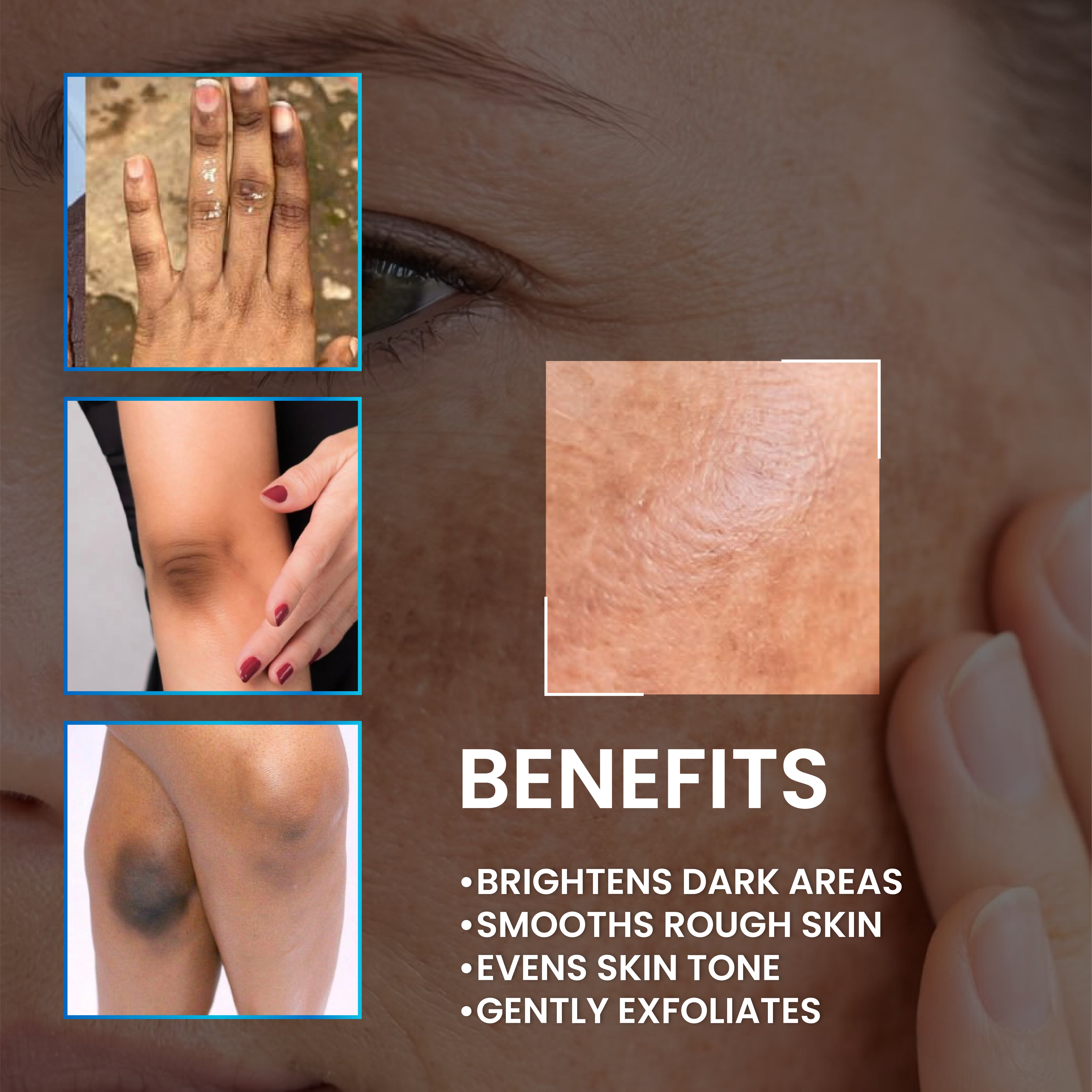 Lume-7 Glycolic Acid