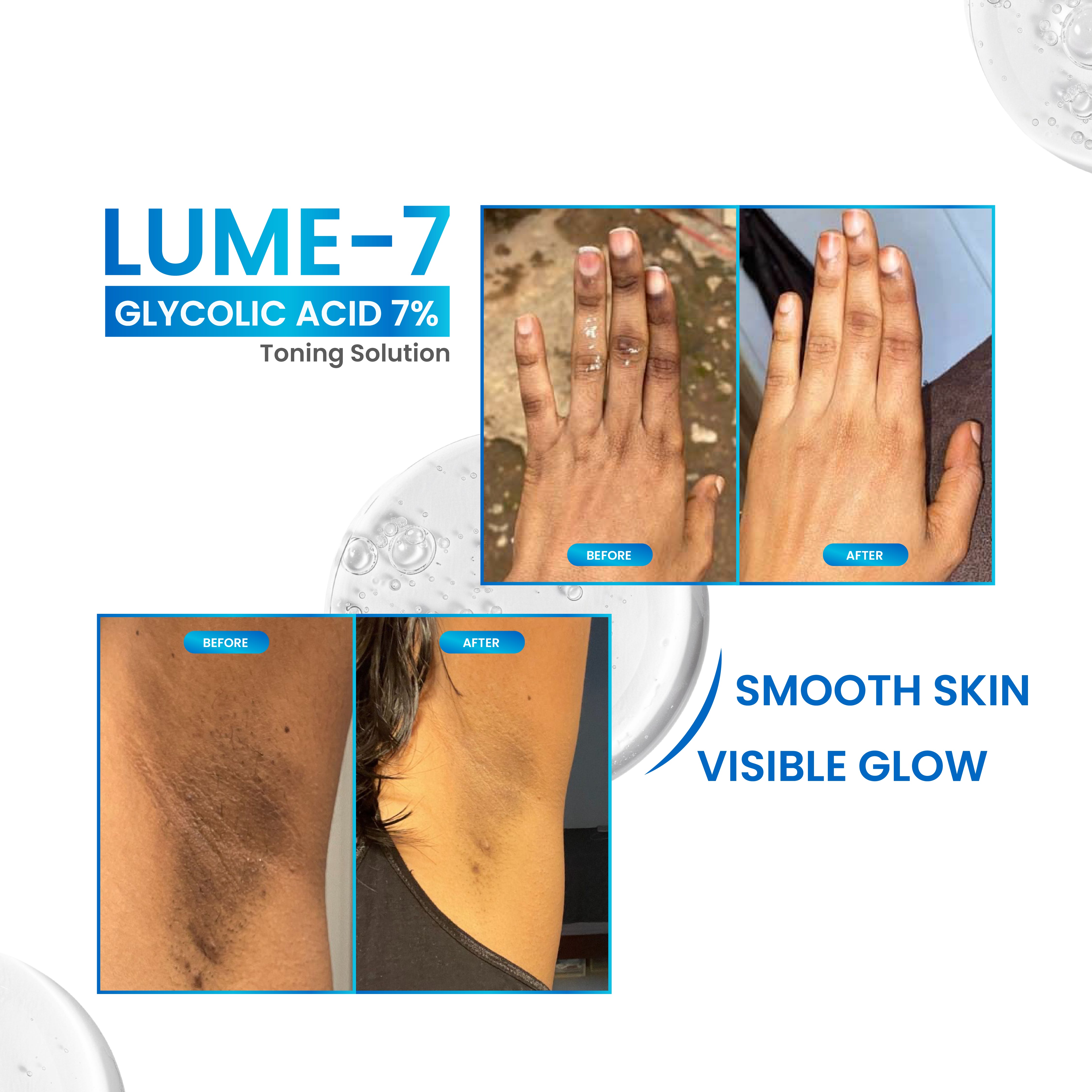 Lume-7 Glycolic Acid