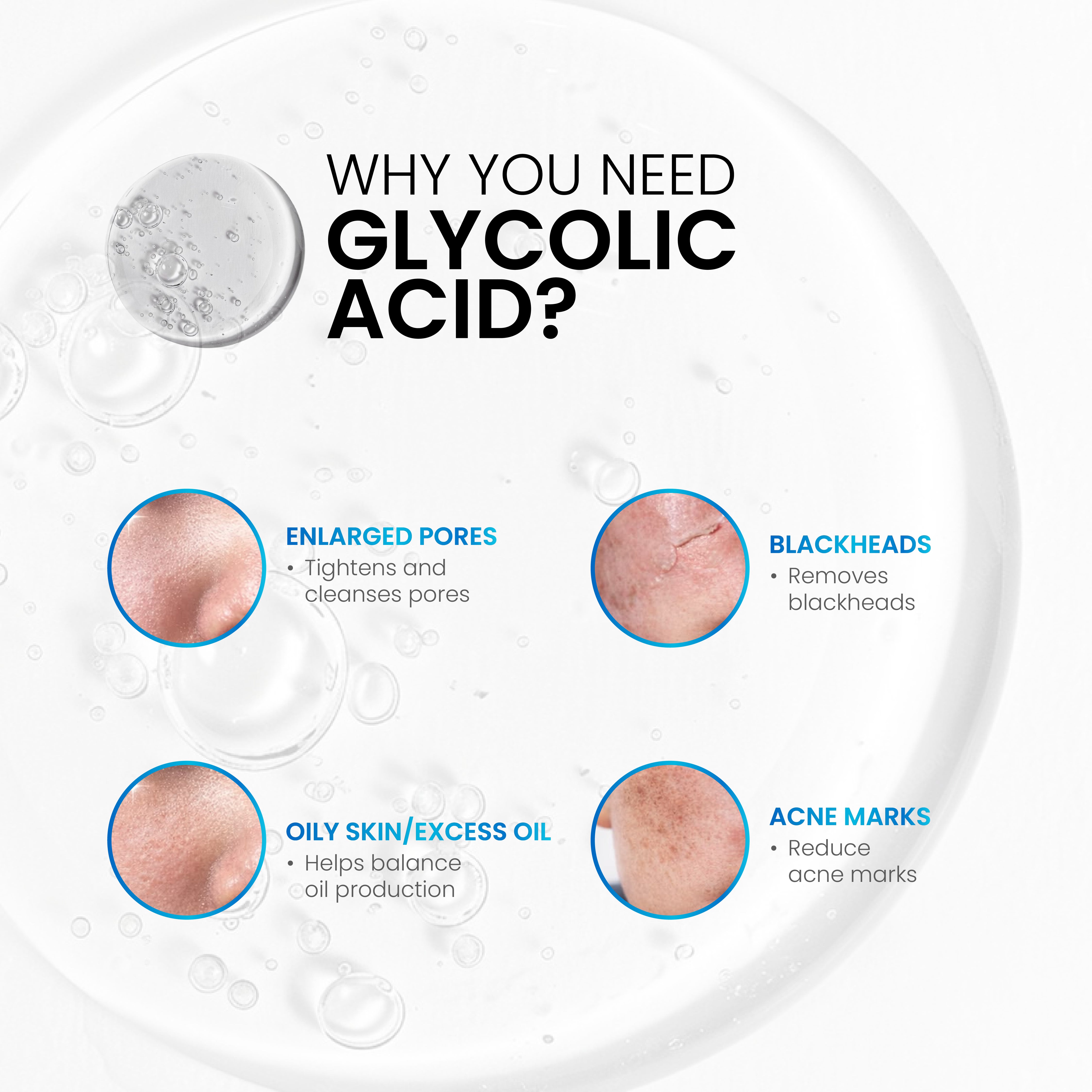 Lume-7 Glycolic Acid